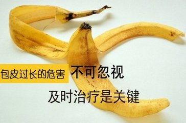 包皮过长定要切吗？什么情况必须要割？