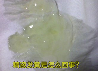 为什么射精后会有腥臭味？吃什么药能好，精液有腥臭味