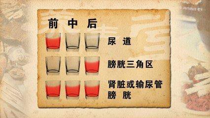 男性小便有血块是怎么回事？如何缓解小便带血