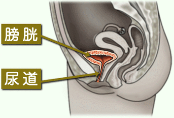 男人憋尿会引起膀胱炎吗？【医生***详细解答】 