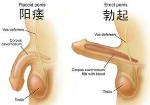 阳萎的自我治疗多少钱？五种方法自我治疗阳痿