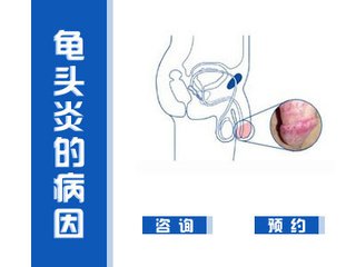 【龟头有白点有没有事】龟头白点怎么办？