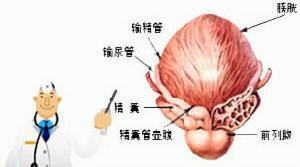 【实图】前列腺炎症状是什么？前列腺炎的危害有哪些？