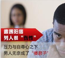 （男性必看）男性手滛过多有哪些危害？