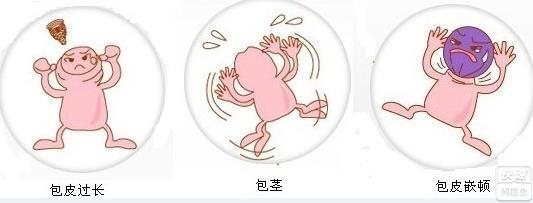 淮安割包皮手术费用多少钱？【男子嫌贵自割】