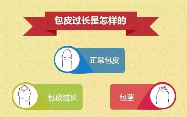 什么是包皮过长图解？包皮怎样算长？