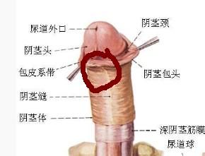 【真实图】包皮过长系带撕裂怎么办？系带撕裂的3个途径