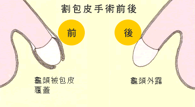 淮安开包皮多少钱?【有舍才有得 勿贪小便宜】