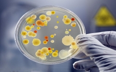 轻微的前列腺炎需要做细菌培养吗？危害不容忽视