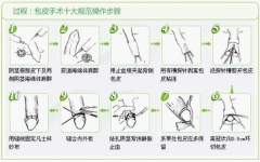 丁丁上那么多血管是怎么做包皮手术的？「图解」