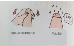 包皮垢清洗教学图片（图）小孩这么洗才靠谱