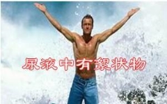 尿液有白色絮状物怎么回事？多喝水还是吃药？