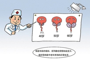 淮安前列腺增生在哪个医