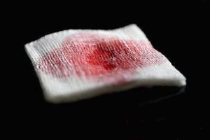割包皮恢复期间纱布渗血，怎么应对才***？