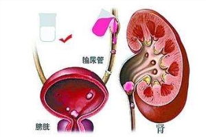 淮安输尿管狭窄哪家医院冶的好？这三方面马虎不得