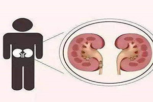 淮安检查肾需要多少钱？理清这几点担心少一点
